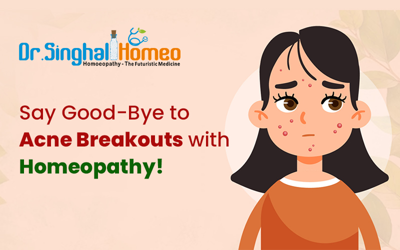 Teen Acne & Homeopathy – A Holistic Approach to Clear & Glowing Skin!